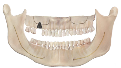 Simplicity in predictable molar rehabilitation Simplicity in predictable molar rehabilitation