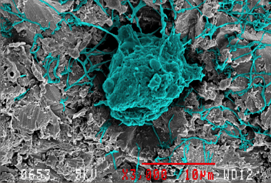 PRIM Surface