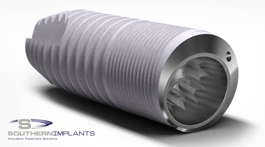 The Surgical and Prosthetic Benefits of the Deep Conical Implant