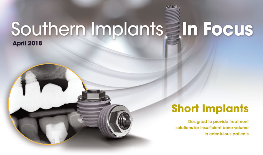 April 2018 – Southern Implants In Focus Newsletter