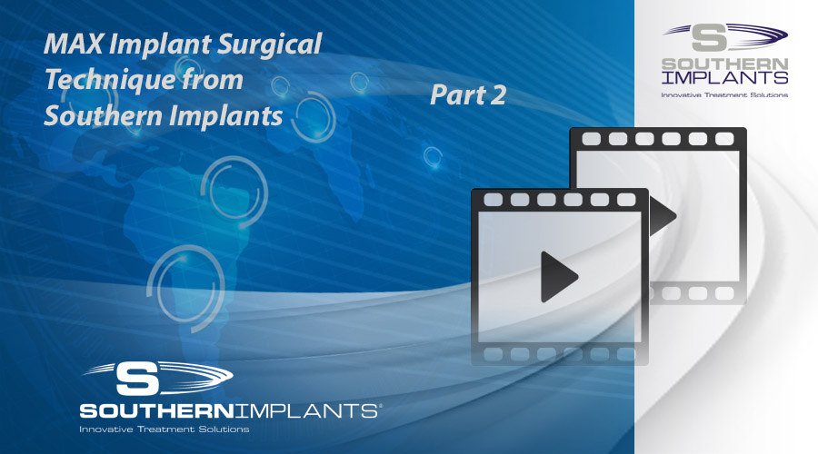 Webinar Part 2: MAX Implant Surgical Technique from Southern Implants