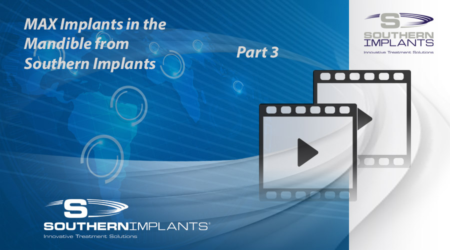 Webinar Part 3: MAX Implants in the Mandible from Southern Implants