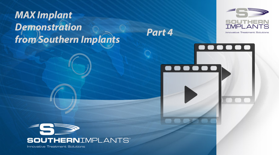 Webinar Part 4: MAX Implant Demonstration from Southern Implants